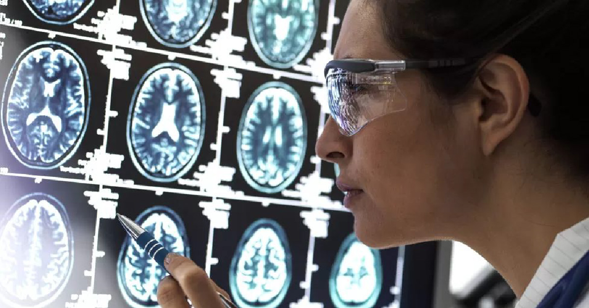 Boas notícias no diagnóstico e tratamento do Alzheimer